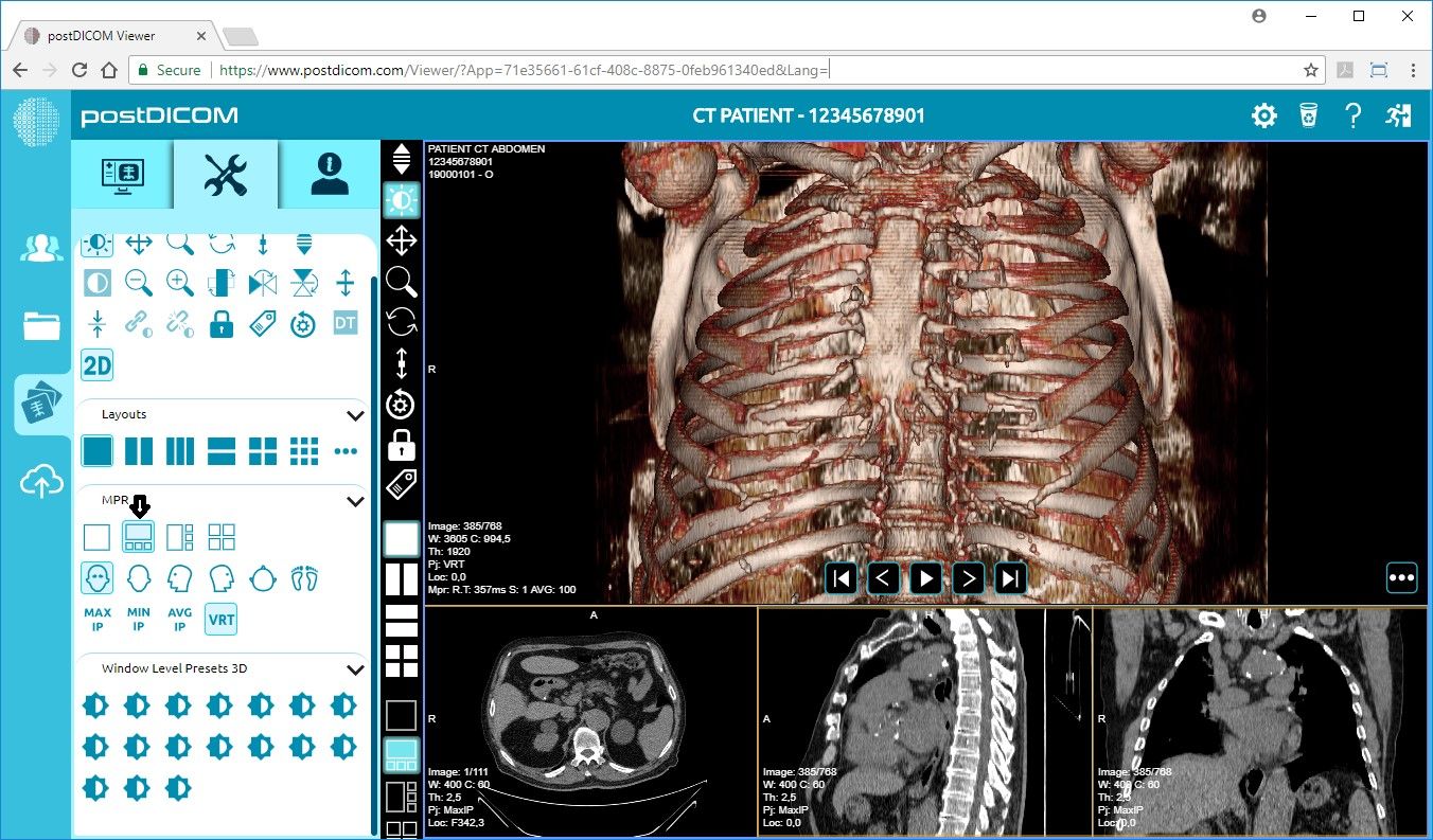 dicom viewer free download for mac